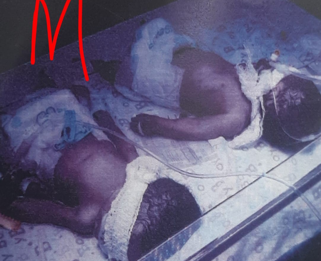 Tears as Police Probe Death of Twin Babies in Edo Hospital